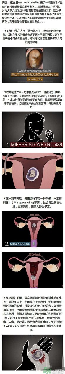 墮胎手術的可怕細節(jié)