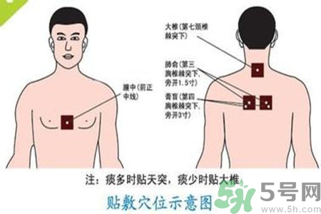 三伏貼能治頸椎病嗎？頸椎病三伏貼穴位