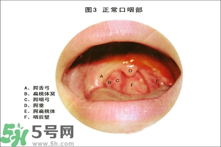 慢性咽炎的治療方法？慢性咽炎的藥物治療？