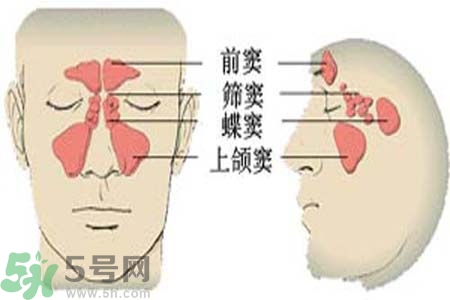 鼻竇炎的治療方法？鼻竇炎的藥物治療？