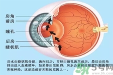 青光眼是什么？青光眼癥狀有什么？