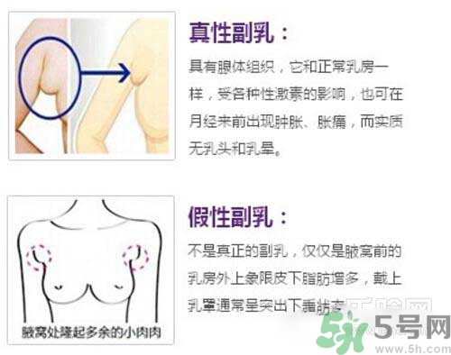 副乳是什么？副乳的危害