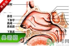 鼻咽癌的發(fā)病因素是什么？鼻咽癌的并發(fā)癥有哪些？