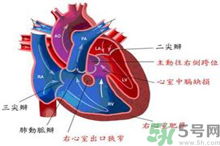 先天性心臟病需要注意什么？