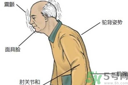 帕金森的易發(fā)人群有哪些？如何預(yù)防帕金森？