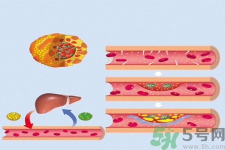 膽固醇對(duì)人體有傷害嗎？膽固醇是什么？