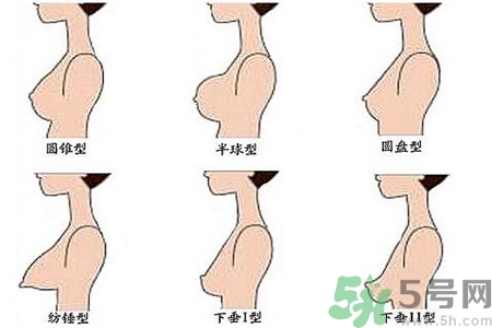 ?女性乳房下垂的原因是什么？女性乳房下垂的分類有哪些？