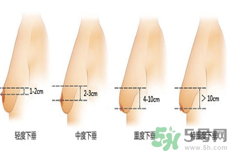 胸部松弛的原因是什么？胸部松弛該怎么辦？