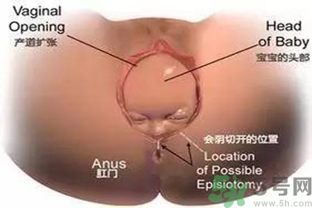 女性陰道松弛的原因是什么？女性陰道松弛怎么辦？