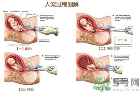 人流后怎么調(diào)養(yǎng)身體？人流后飲食需注意什么？