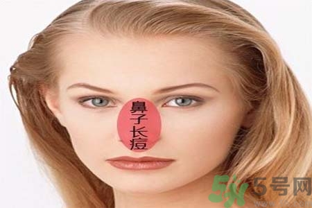 鼻翼長(zhǎng)痘痘怎么回事？鼻翼長(zhǎng)痘痘的原因是什么？