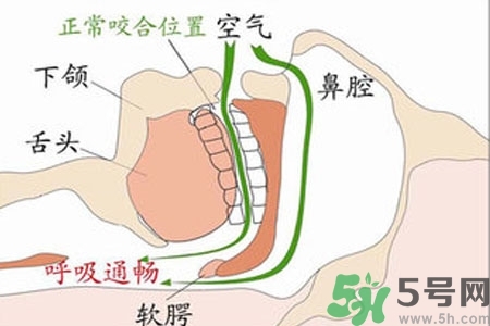 鼻子紅是什么原因？鼻子紅怎么辦？