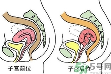 ?子宮移位怎么治療？子宮移位能懷孕嗎？