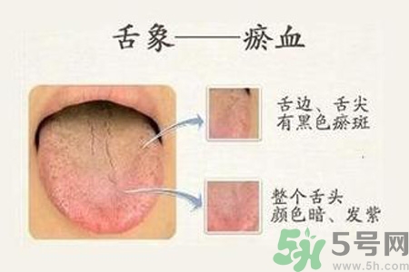 血瘀體質吃什么？血瘀體質怎么調理？