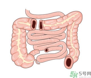 腸炎肚子疼怎么辦？腸炎肚子疼怎么緩解？