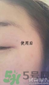 dr.jart適合什么年齡層？蒂佳婷適合年齡