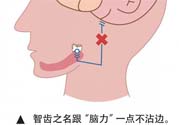 長智齒疼痛怎么辦？長智齒牙齦腫了怎么辦？