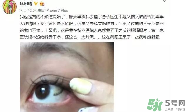 隱形眼鏡會碎嗎?隱形眼鏡碎在眼睛里怎么辦?