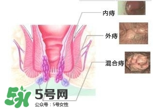 痔瘡吃什么藥效果好？痔瘡吃什么藥好得快？