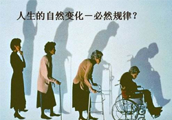 哪些人容易得骨質(zhì)疏松癥？骨質(zhì)疏松的高發(fā)人群有哪些？