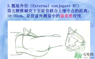 盆骨多大適合順產(chǎn) 盆骨多大可以順產(chǎn)