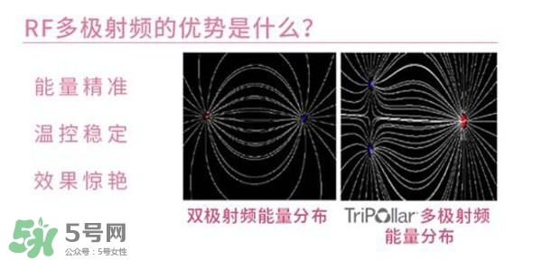 tripollar stop怎么樣？tripollar pose好用嗎