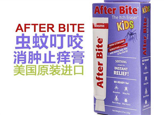 after bite止癢膏好用嗎？after bite止癢膏怎么樣？