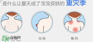 妙思樂爽膚水好用嗎？妙思樂爽膚水能去痱嗎？