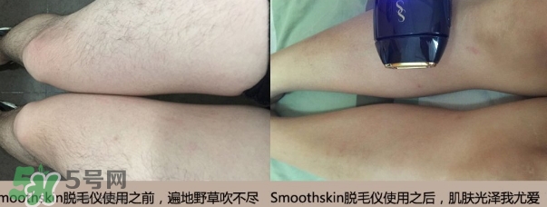 smoothskin和slikn infinity哪個好？smoothskin脫毛儀怎么樣