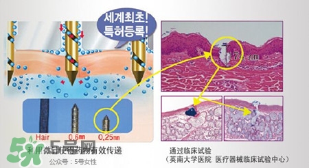 珠兒麗蚊子針好用嗎？珠兒麗蚊子針副作用