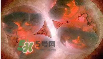 多胞胎順產(chǎn)怎么生？多胞胎剖腹產(chǎn)和單胎剖腹產(chǎn)的區(qū)別