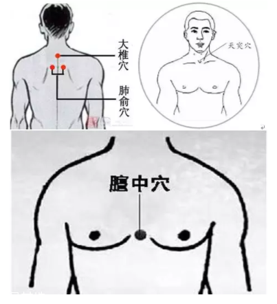 吮痧有什么療效？最溫柔的治病方法