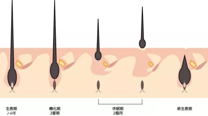 頭發(fā)為什么會(huì)掉？毛囊想休息了