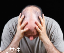 脫發(fā)有沒有治？只要不是禿子就有得治