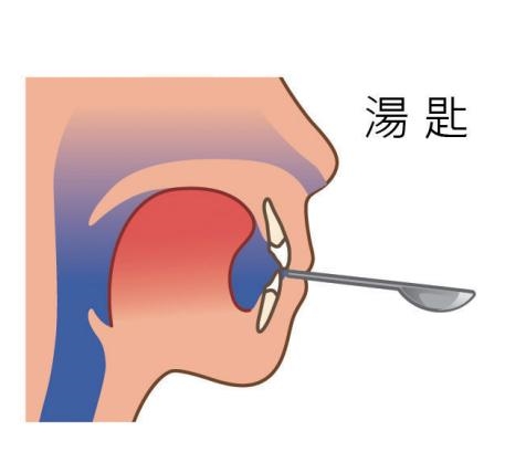 鼻塞怎么快速通氣 含溫水?dāng)[頭3分鐘