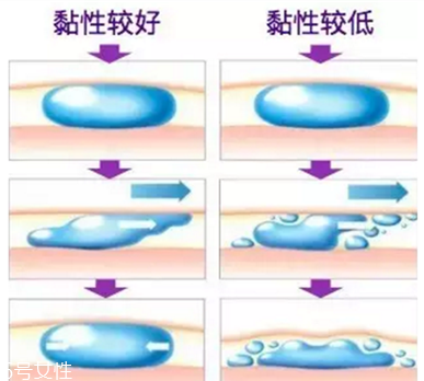 伊婉玻尿酸有幾個(gè)型號(hào) 伊婉c型和v型的區(qū)別