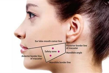 瘦臉針適合哪種臉型 瘦臉針適合多大年紀(jì)打