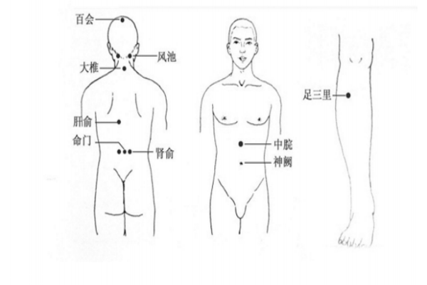 中醫(yī)針灸療法中艾灸 能有效治療頭痛癥狀