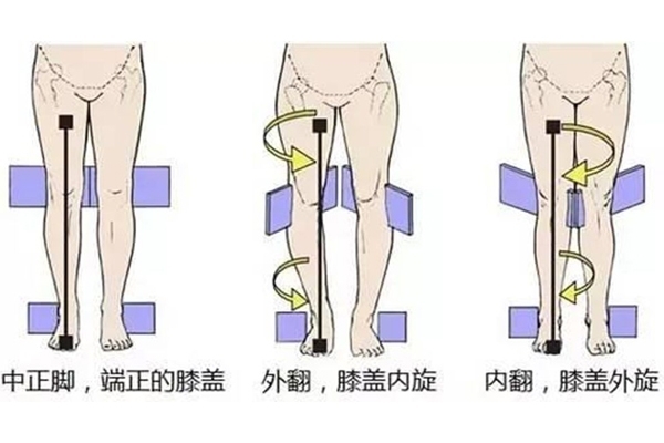 小腿外擴怎么矯正 5招擁有筆直美腿