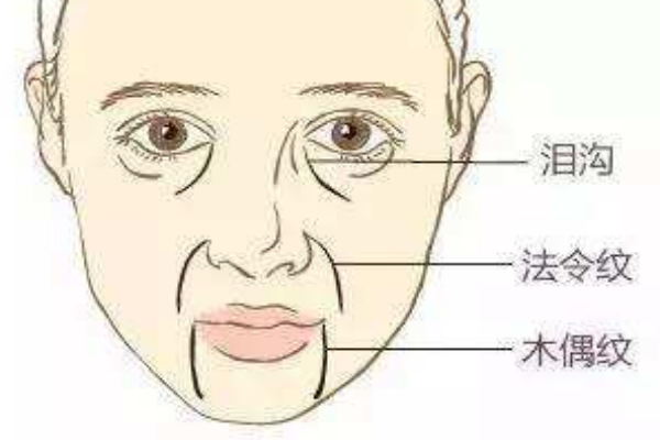 木偶紋怎么消除 讓你笑起來(lái)更自信