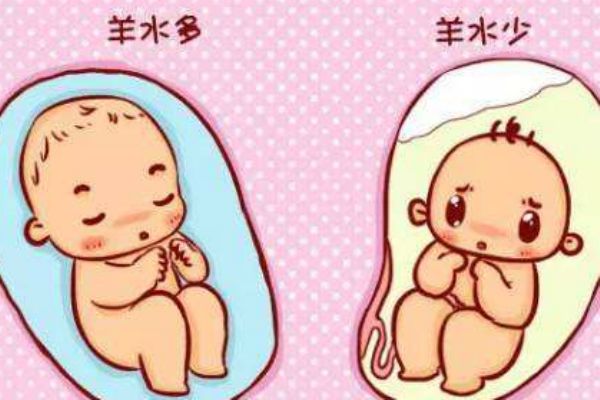 孕婦羊水過(guò)多什么癥狀 媽媽們要注意