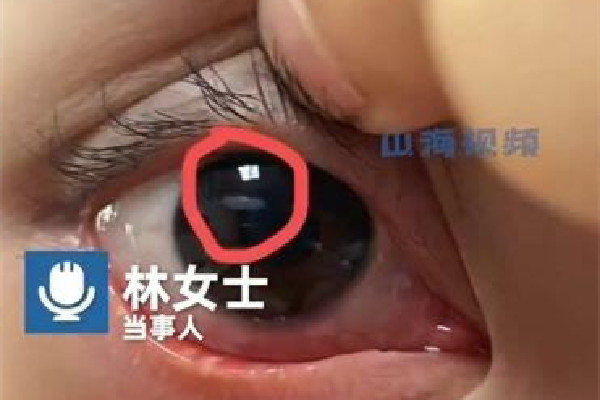 女生用發(fā)卡燙睫毛眼球燙個(gè)泡 燙睫毛對(duì)睫毛傷害大嗎